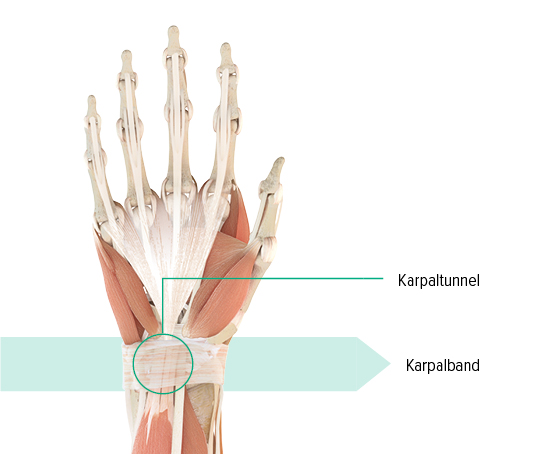 Anatomische Zeichnung - Linke Hand Anatomie-Grafik der linken Hand mit Markierung des Karpaltunnels und des Karpalbandes
