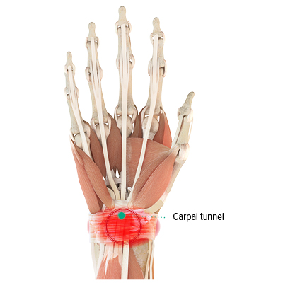 Anatomical depiction - right hand, palmar view Anatomical depiction of the right hand with the carpal tunnel marked - palm
