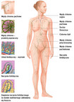 Układ limfatyczny człowieka – przegląd
