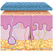 Illustration : Cicatrice aplatie sous le tricot de compression