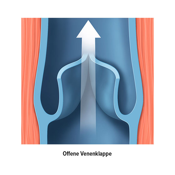 Venenklappe offen Venenklappe offen