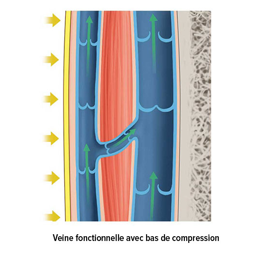Veine fonctionnelle avec bas de compression
