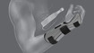 Illustration - removable stabilisation stay, JuzoPro Manu Xtec Palmar wrist support