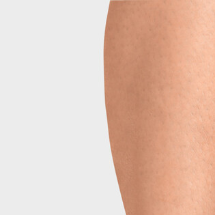 Malleo Xtra Anatomic, Anthrazit Fuß mit Sprunggelenkbandage Malleo Xtra Anatomic