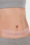 Juzo ScarPad, application on the abdomen